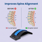 SpineRelief™ Back Stretcher
